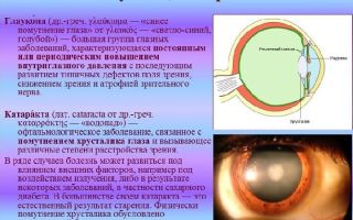 Чем отличается катаракта от глаукомы