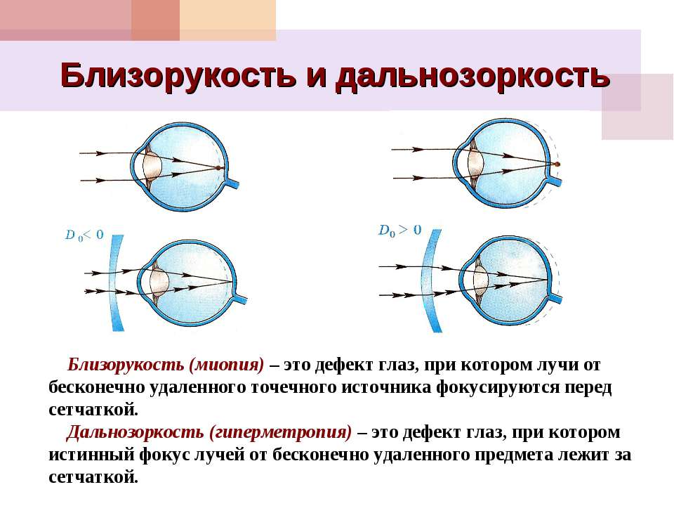 Проект на тему близорукость и дальнозоркость